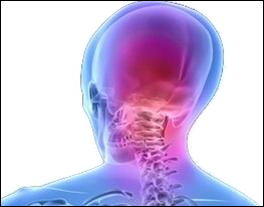 headache-cerv
